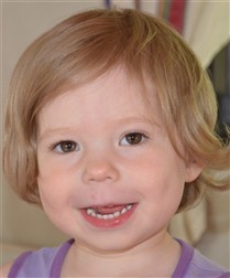 Allison